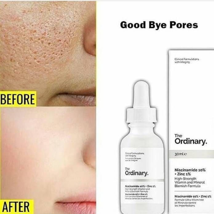 The Ordinary Niacinamide 10% + Zinc 1 %